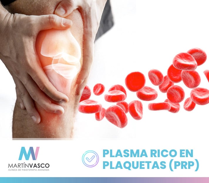 Plasma rico en plaquetas (PRP) o factores de crecimiento aplicados a los tratamientos de fisioterapia